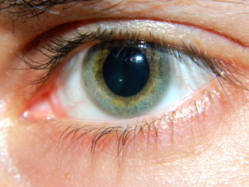 EYE